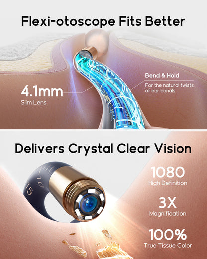 Bebird EarSight Plus I35R – 2026 HD Visual Ear Cleaner with Bendable Tweezers & All-in-One Wax Removal Kit